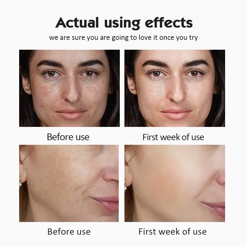Ampoule Serum Set  Moisturising Whitening
